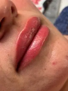 IMG 1444